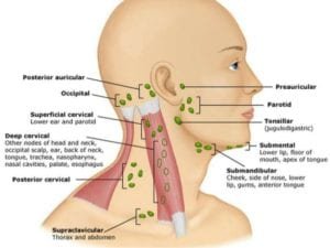 causes of swollen left supraclavicular lymph nodes