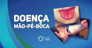 Doenca Mao-Pe-Boca Pediatria - social