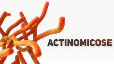 Actinomicose - pediatria